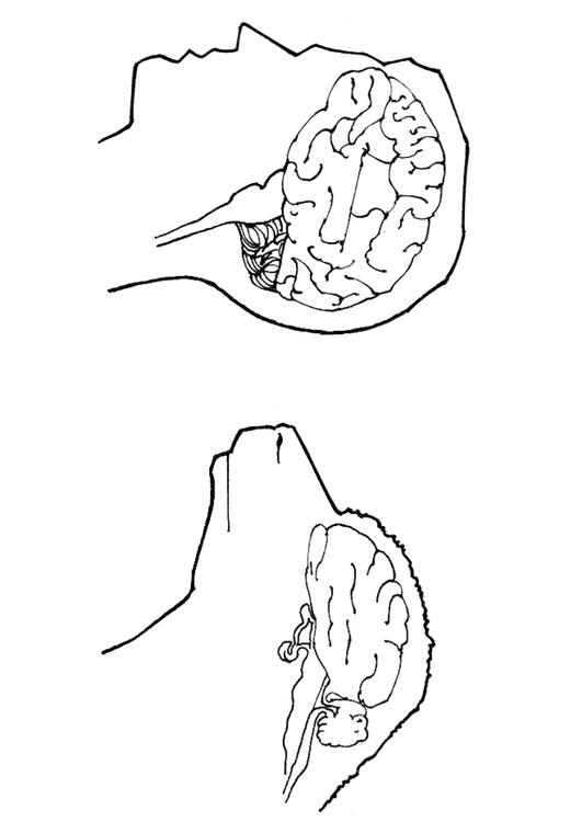 cervello del uomo e della pecora