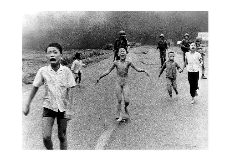 bambini dopo attacco napalm Foto bambini dopo attacco napalm