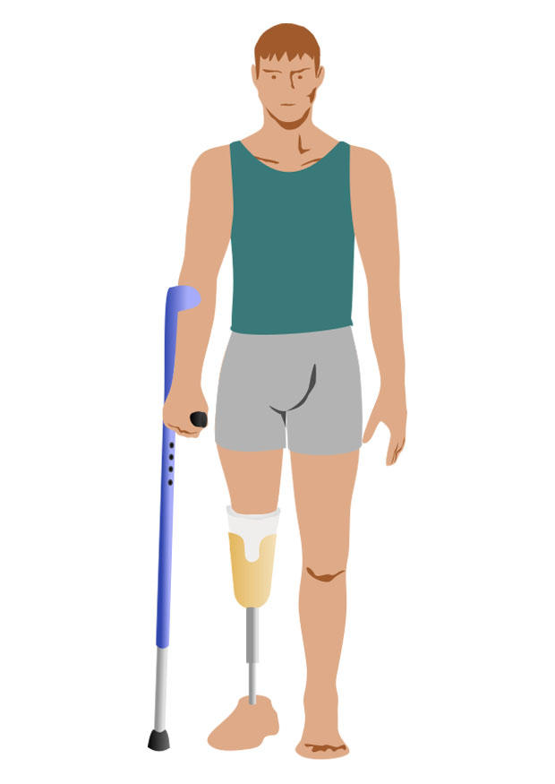 disabile immagine disabile