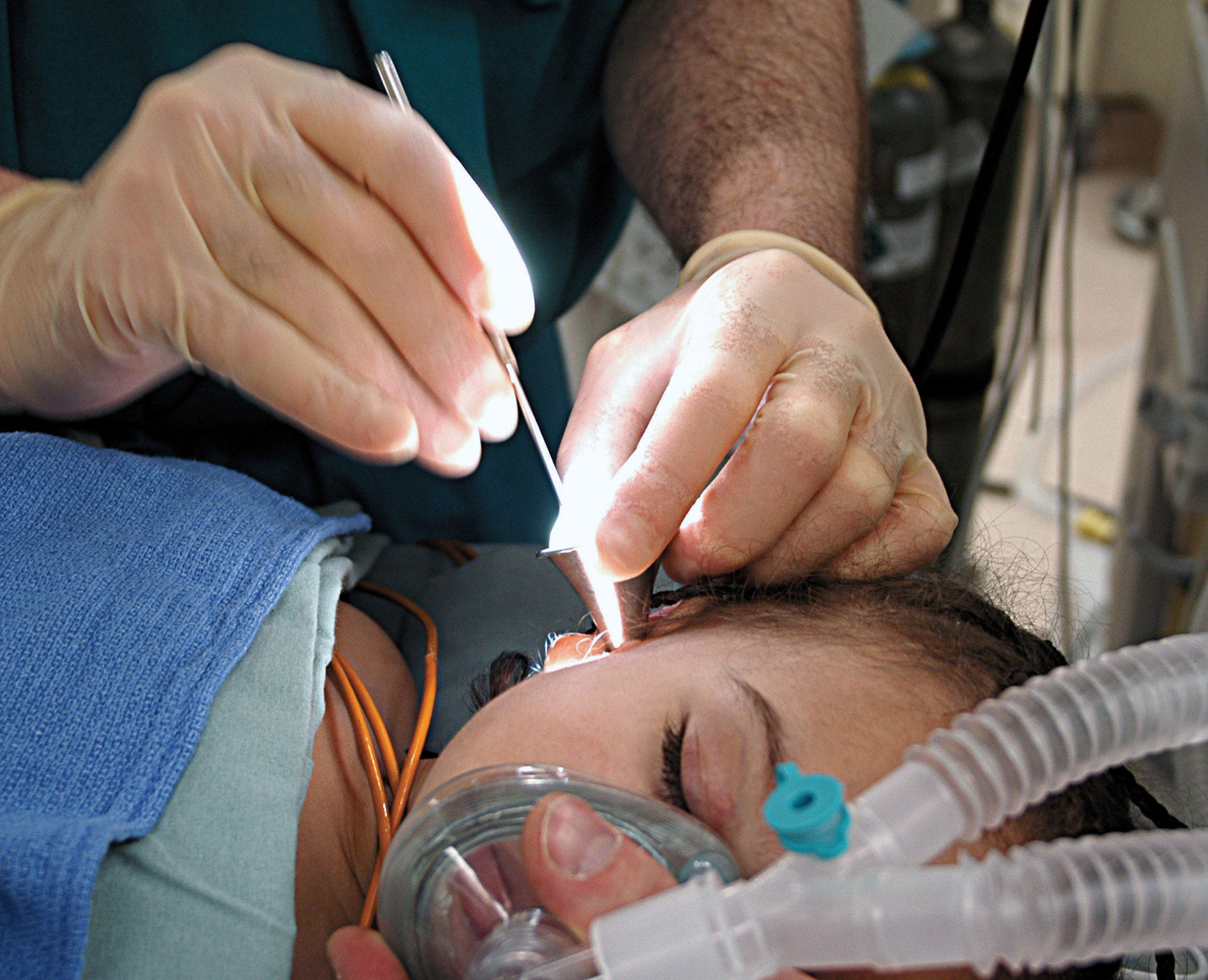 operazione Foto operazione